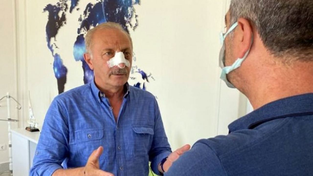 Aydın Didim’de Başkanı Atabay’a saldırı anı görüntüleri yayınlandı