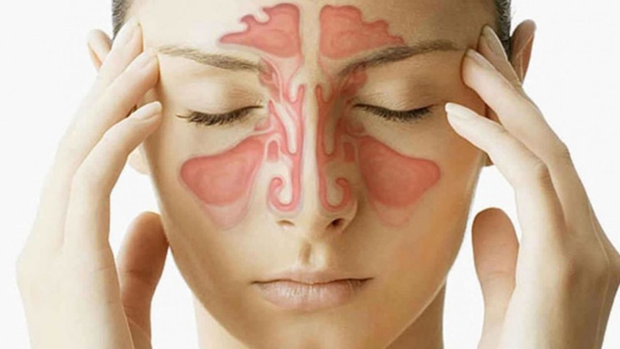 Sinüzit pek çok hastanın hayat kalitesini bozuyor