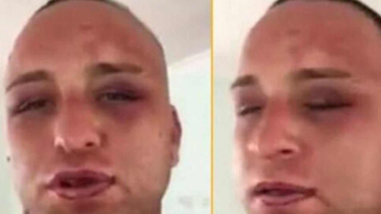 Rum mahkumlar Survivor Taner'i komalık ettiler!