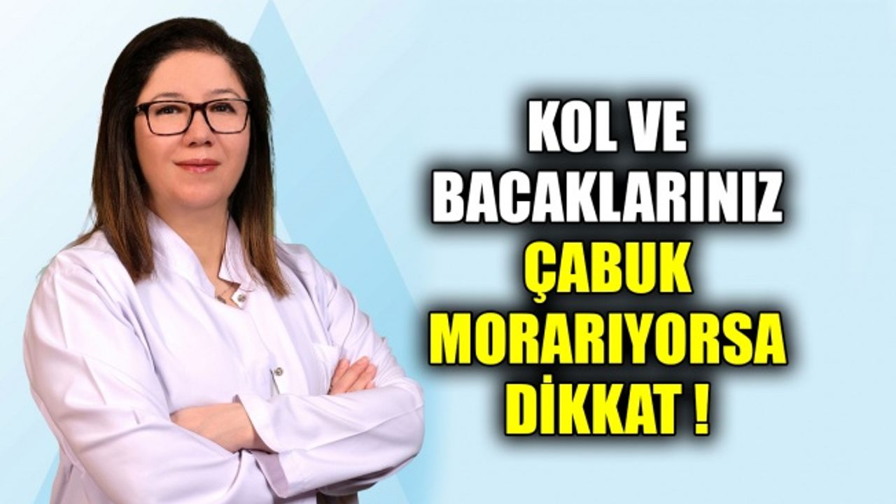 Kol ve bacaklarınız çabuk morarıyorsa dikkat !
