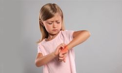 Yaz aylarına dikkat: Molluscum enfeksiyonu daha kolay bulaşıyor!