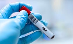Prostat kanserinin sessiz yüzü: Belirti vermeden ilerleyebiliyor