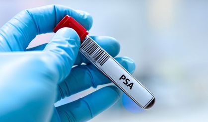 Prostat kanserinin sessiz yüzü: Belirti vermeden ilerleyebiliyor