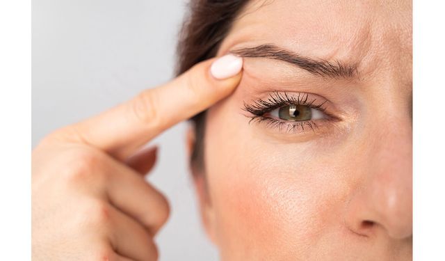 Göz seğirmesi her zaman masum olmayabilir: Blefarospazm nedir?
