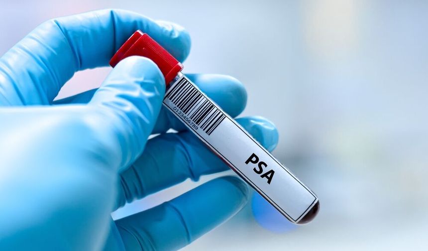 Prostat kanserinin sessiz yüzü: Belirti vermeden ilerleyebiliyor